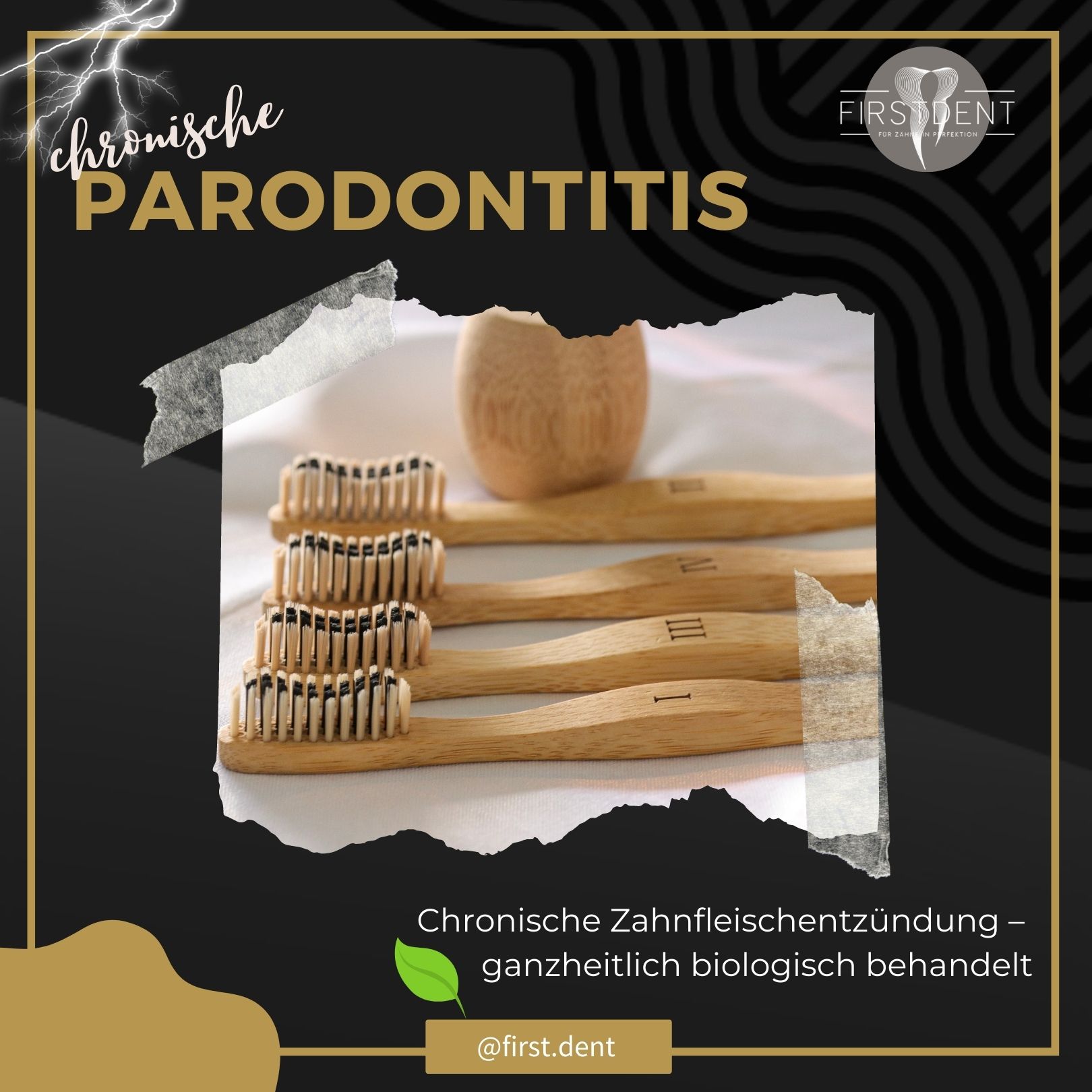 Parodontitis ganzheitlich biologisch behandeln